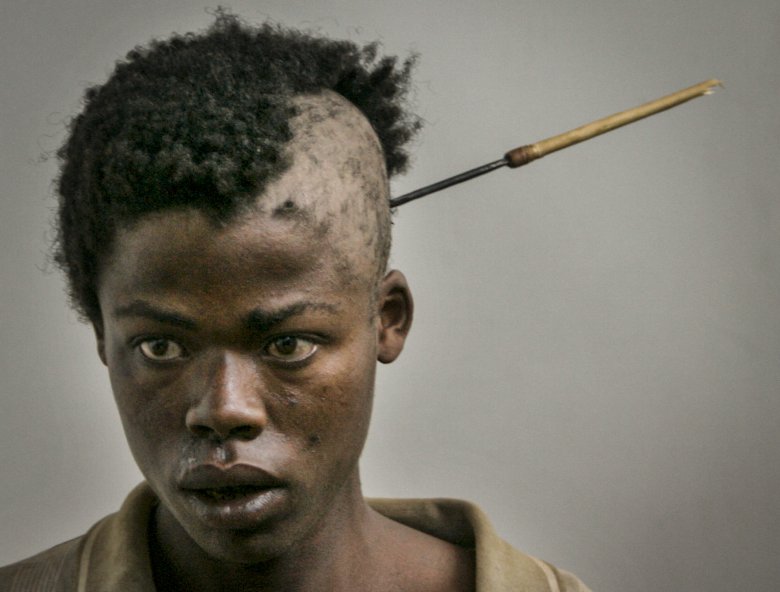 Młody mężczyzna wchodzi do szpitala w Nakuru ze strzałą w głowie.