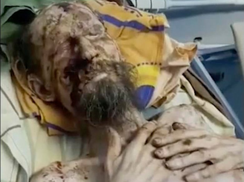 Mężczyzna przeleżał około miesiąca w jaskini niedźiedzia.